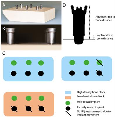 The Use of Cone Beam Computed Tomography in Assessing the Insertion of Bone Conduction Hearing Implants
